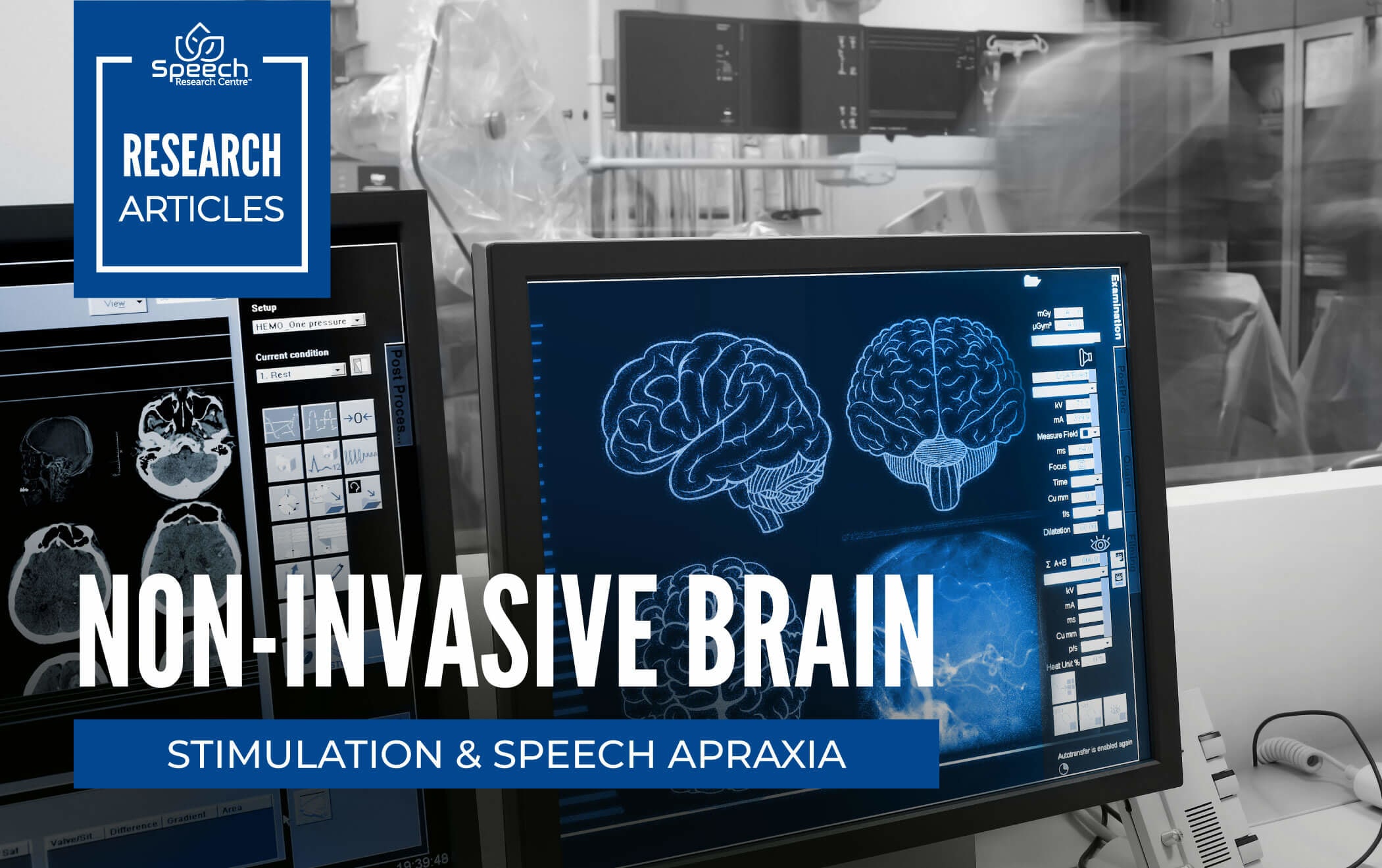 computer monitors showing brain MRI